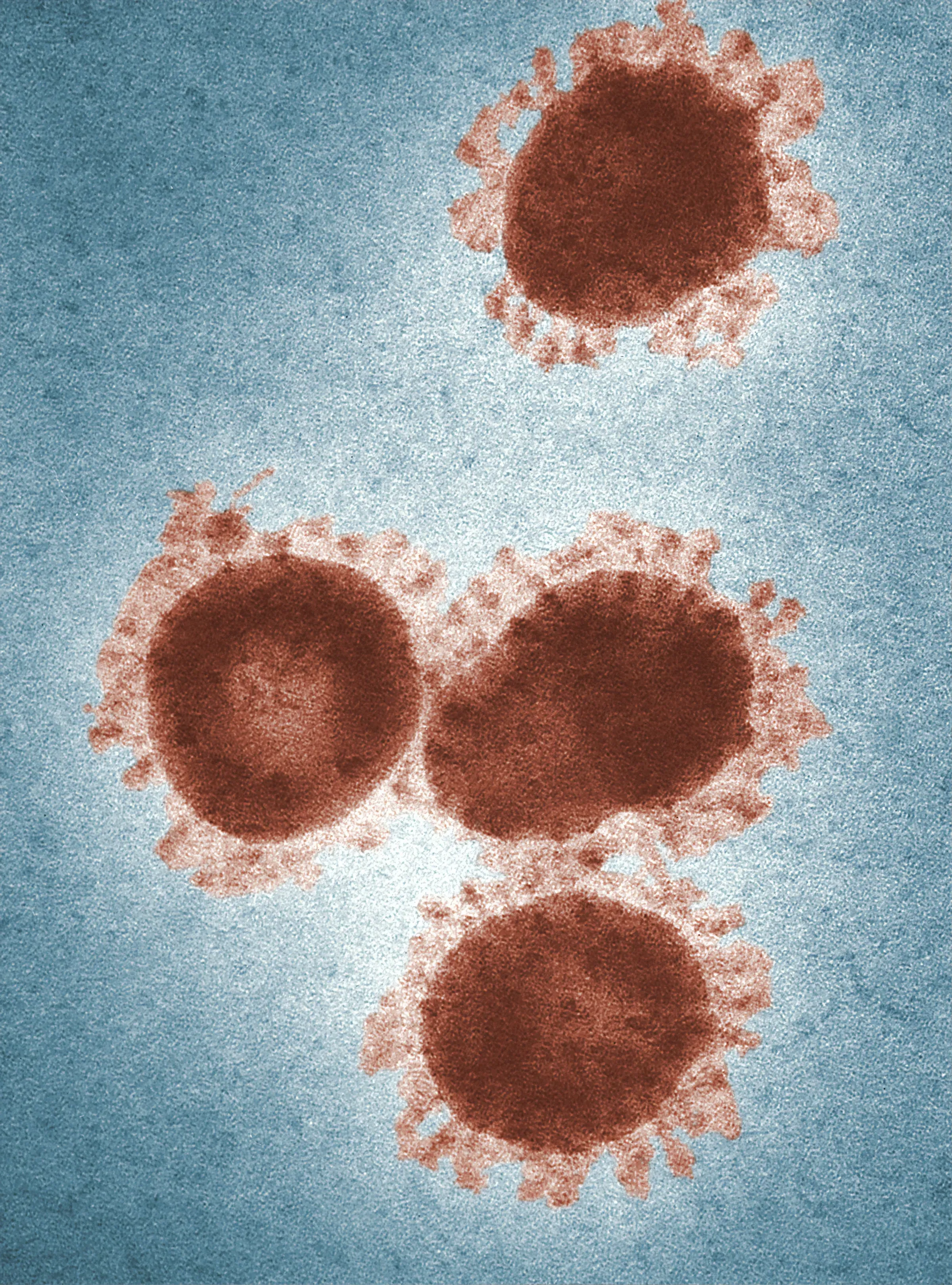 95% of Adults Have Epstein-Barr Virus: How it Increases Your Risk of Cancer