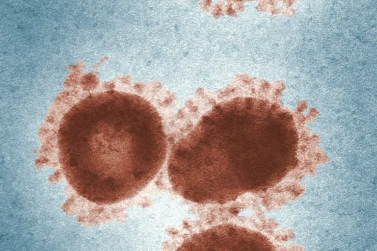 95% of Adults Have Epstein-Barr Virus: How it Increases Your Risk of Cancer