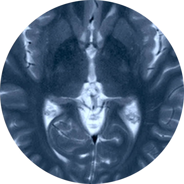 Full Body MRI Scan