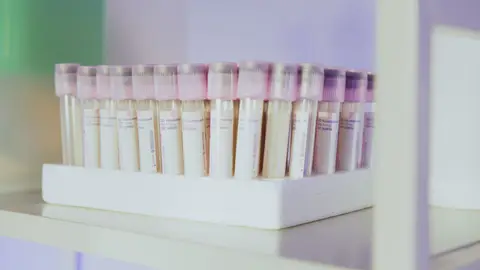 CBC Test Cost: What a Complete Blood Count Costs Across Labs