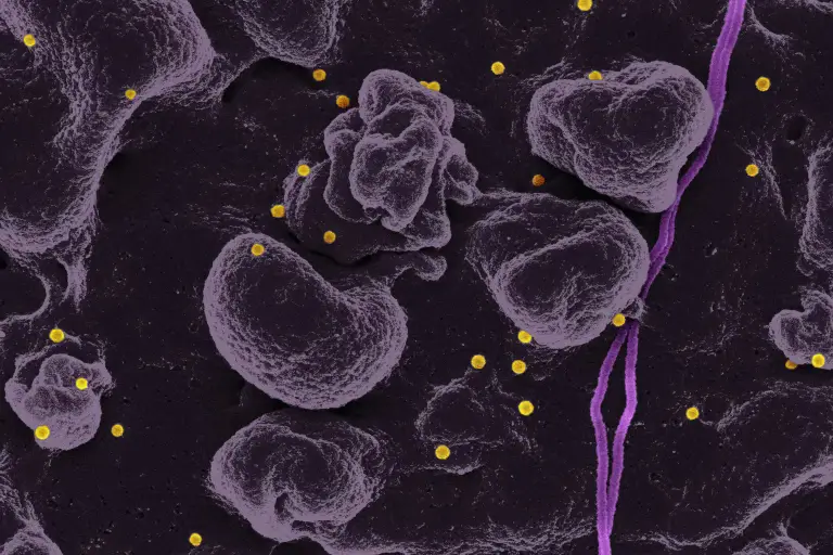 Low Progesterone Symptoms and What the Result Means