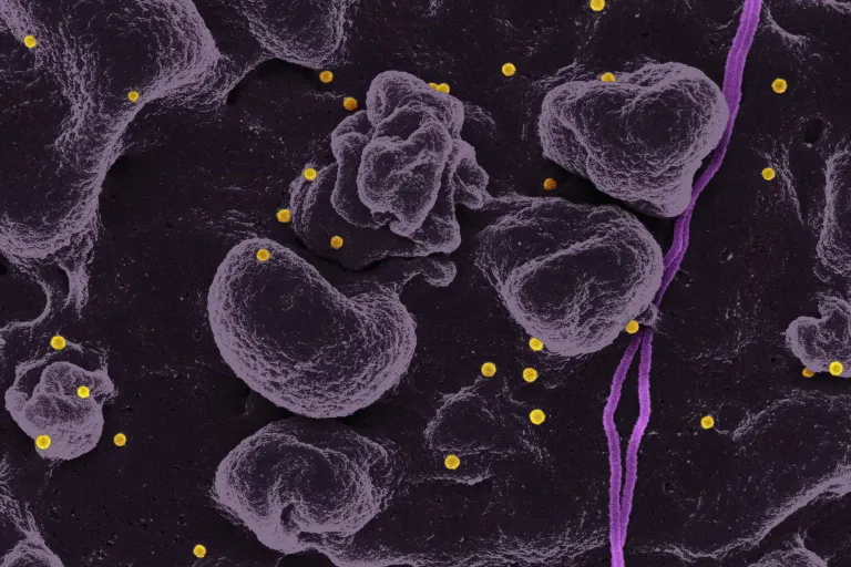 High Direct Bilirubin Symptoms: Causes, Signs & What to Do