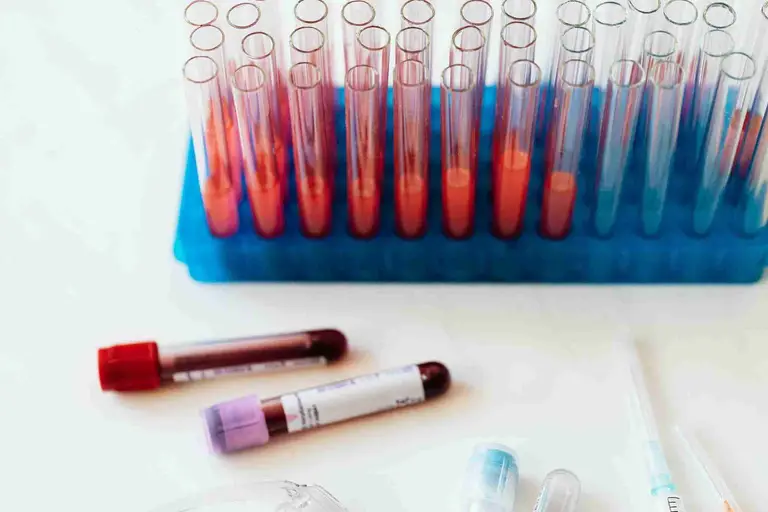 How to Reduce WBC Count Naturally