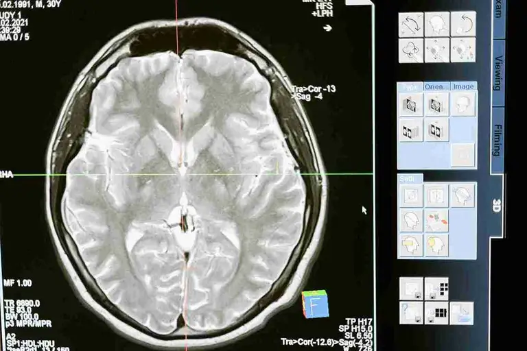 supplements for brain health