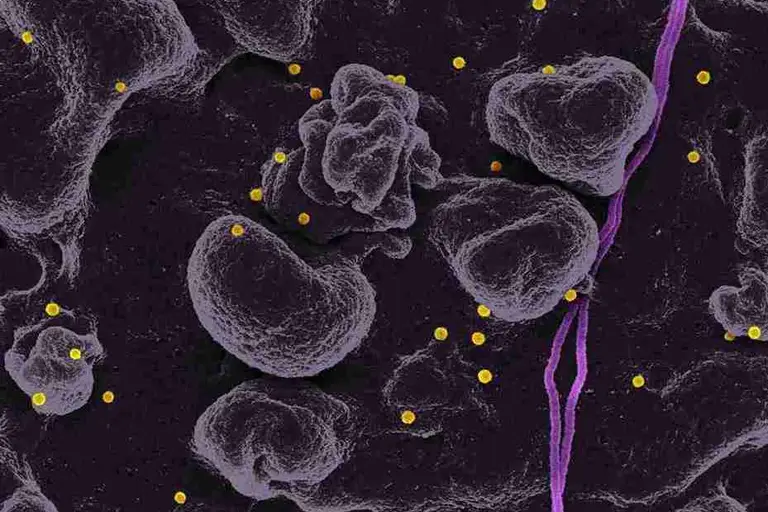 Elevated Basophils: What a High Count Means