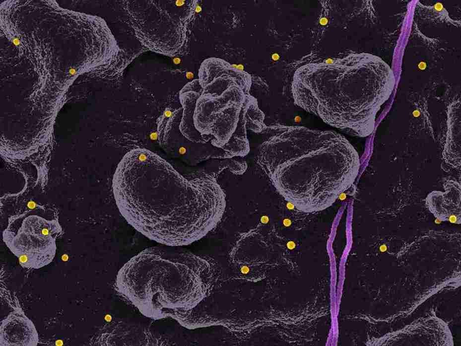Elevated Basophils: What a High Count Means