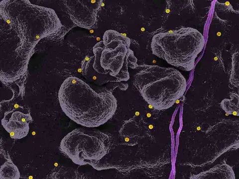 Elevated Basophils: What a High Count Means