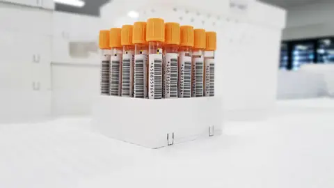 How Peptides May Support Metabolic Health