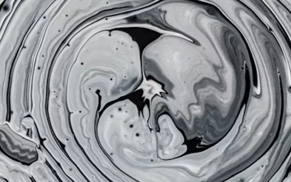 Prenuvo Full Body MRI Scan