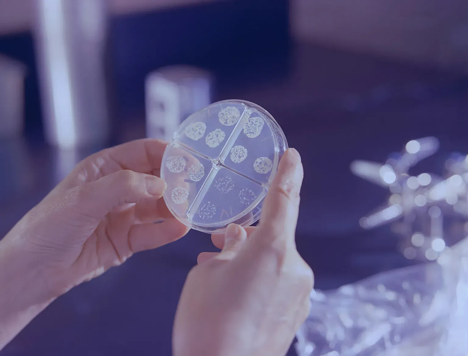 Laboratory worker examining a divided culture dish used for tuberculosis testing
