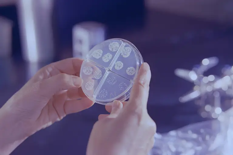 Laboratory worker examining a divided culture dish used for tuberculosis testing