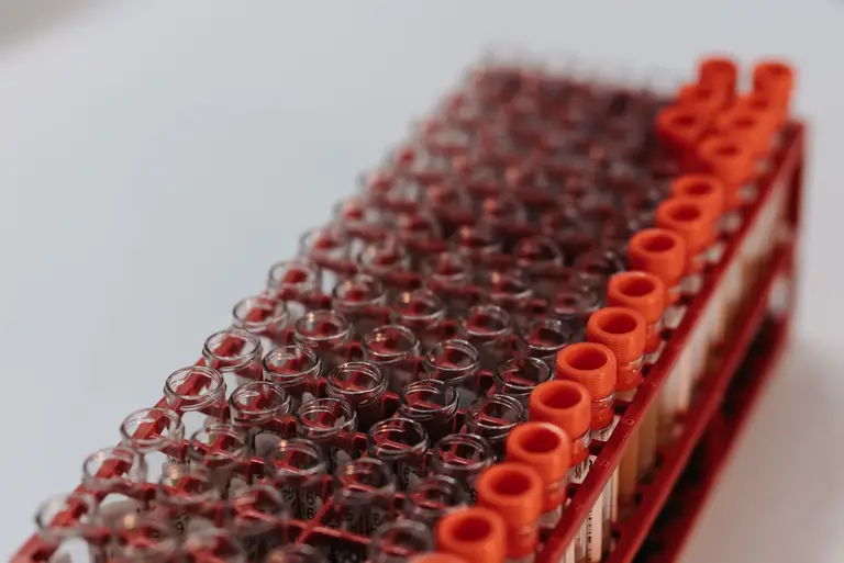 How Much Does a Blood Test Cost? 29 Common Tests Compared Across 14 Labs