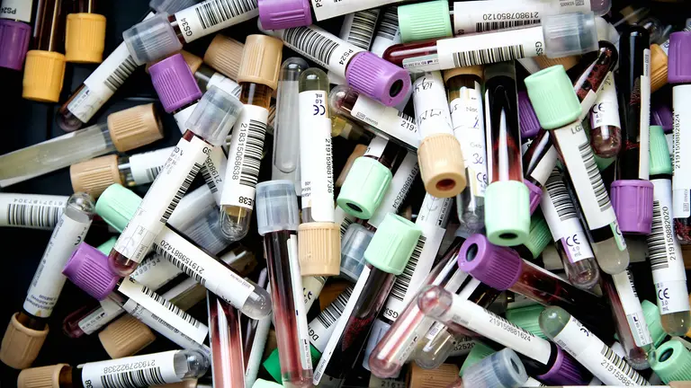 A close-up of blood sample tubes used to measure estradiol, progesterone, and other hormone biomarkers, helping detect perimenopause or menopause symptoms.
