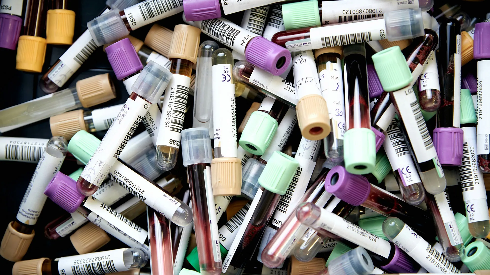 A close-up of blood sample tubes used to measure estradiol, progesterone, and other hormone biomarkers, helping detect perimenopause or menopause symptoms.