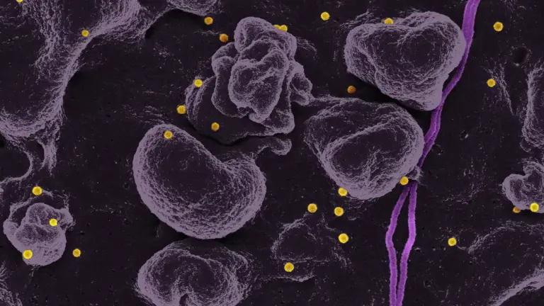Low Ferritin Symptoms and What the Result Means