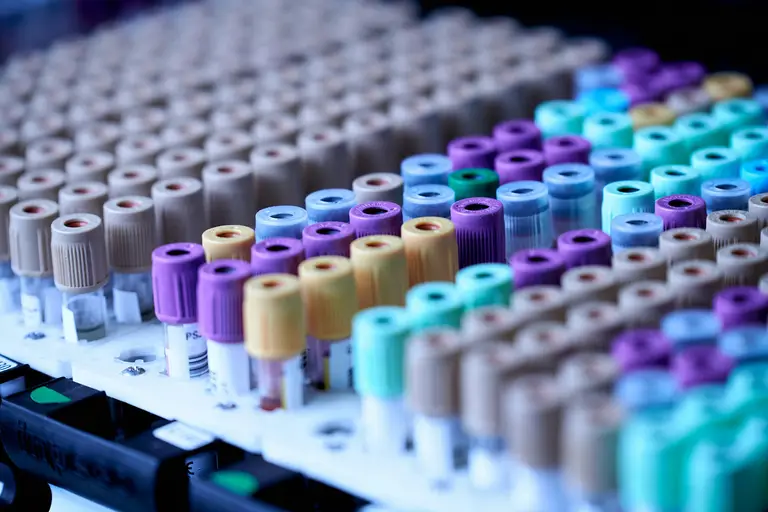 A close-up of multiple color-coded blood test tubes, symbolizing lab tests to identify underlying factors contributing to restless nights and insomnia.