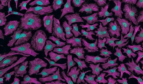 Could Low Magnesium Raise Your Prostate Cancer Risk? Recent Study Suggests Yes