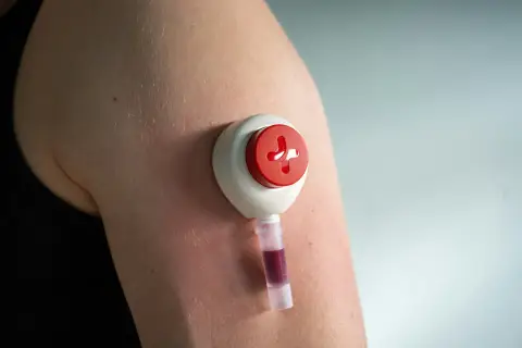 An upper-arm blood collection device filling a small sample tube