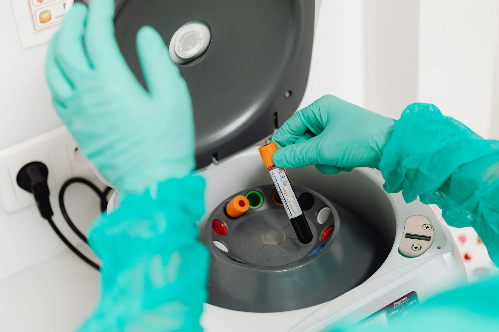 Understanding Your Metabolic Test Results