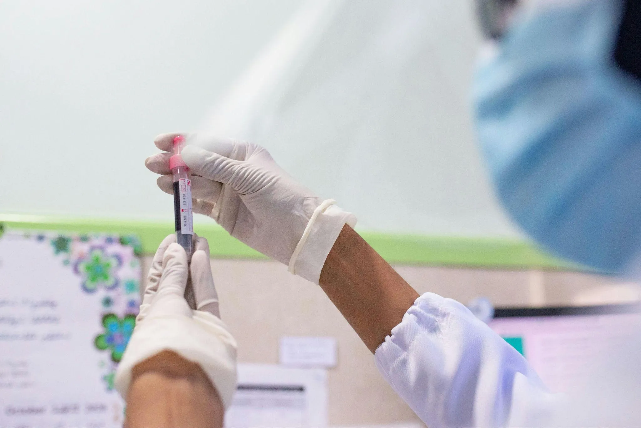 How Testing and Diagnosis Improve PCOS Management