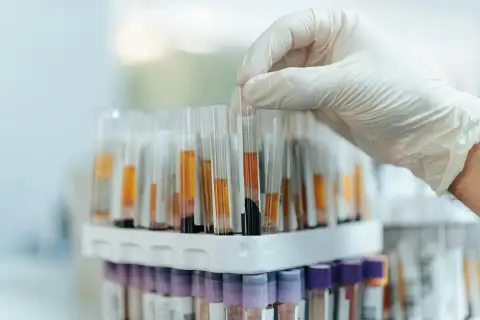 Person reviewing paperwork while planning lab testing costs