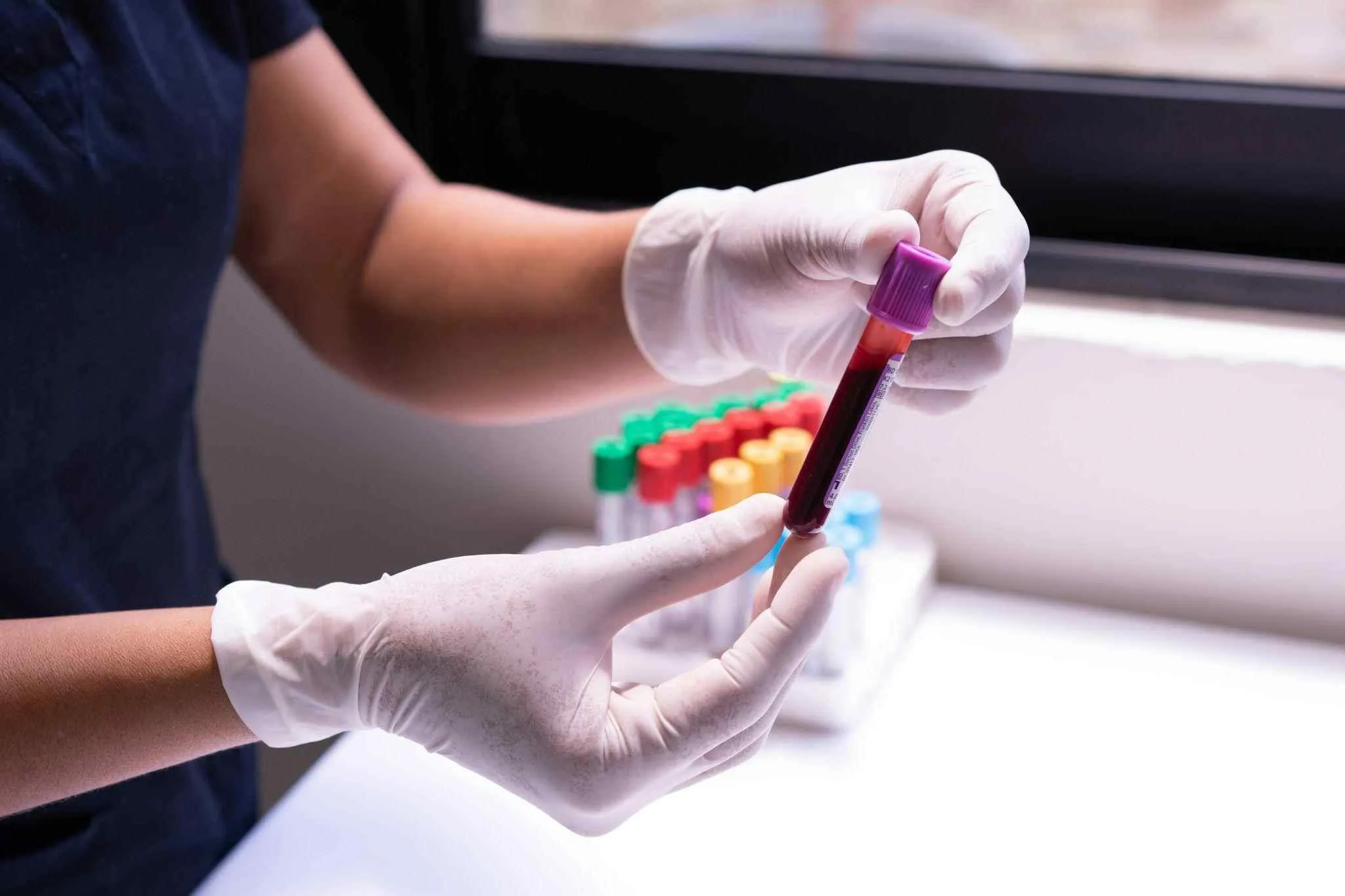 What Is Ferritin and Why Is It So Important?