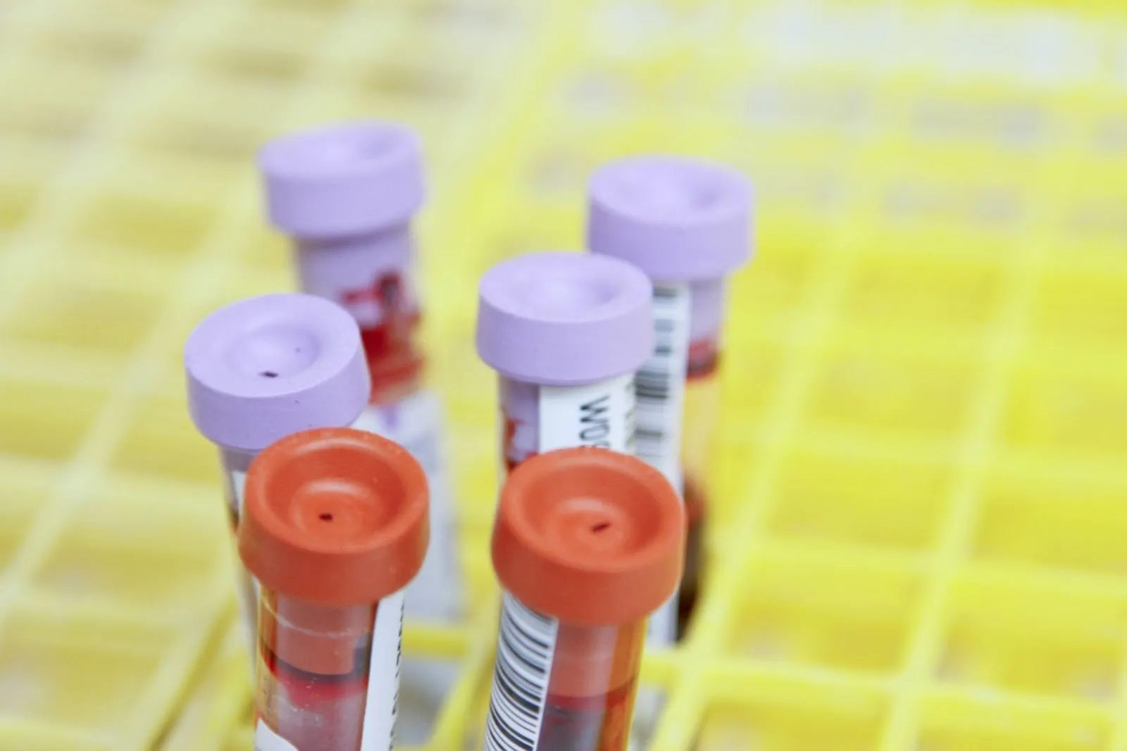 A blood test can measure high-sensitivity C-reactive protein