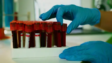 Laboratory medical testing for thyroid health