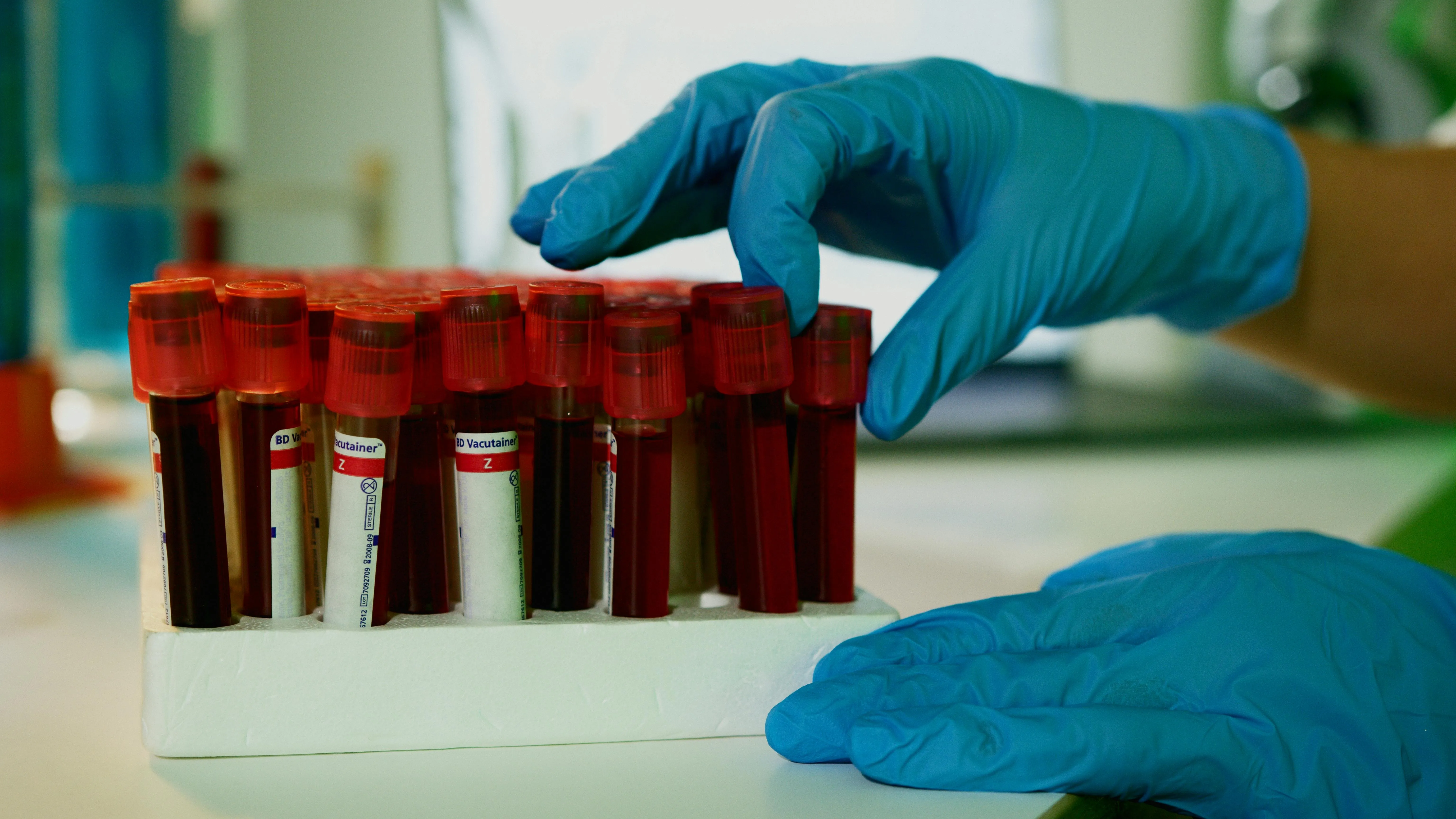Laboratory medical testing for thyroid health