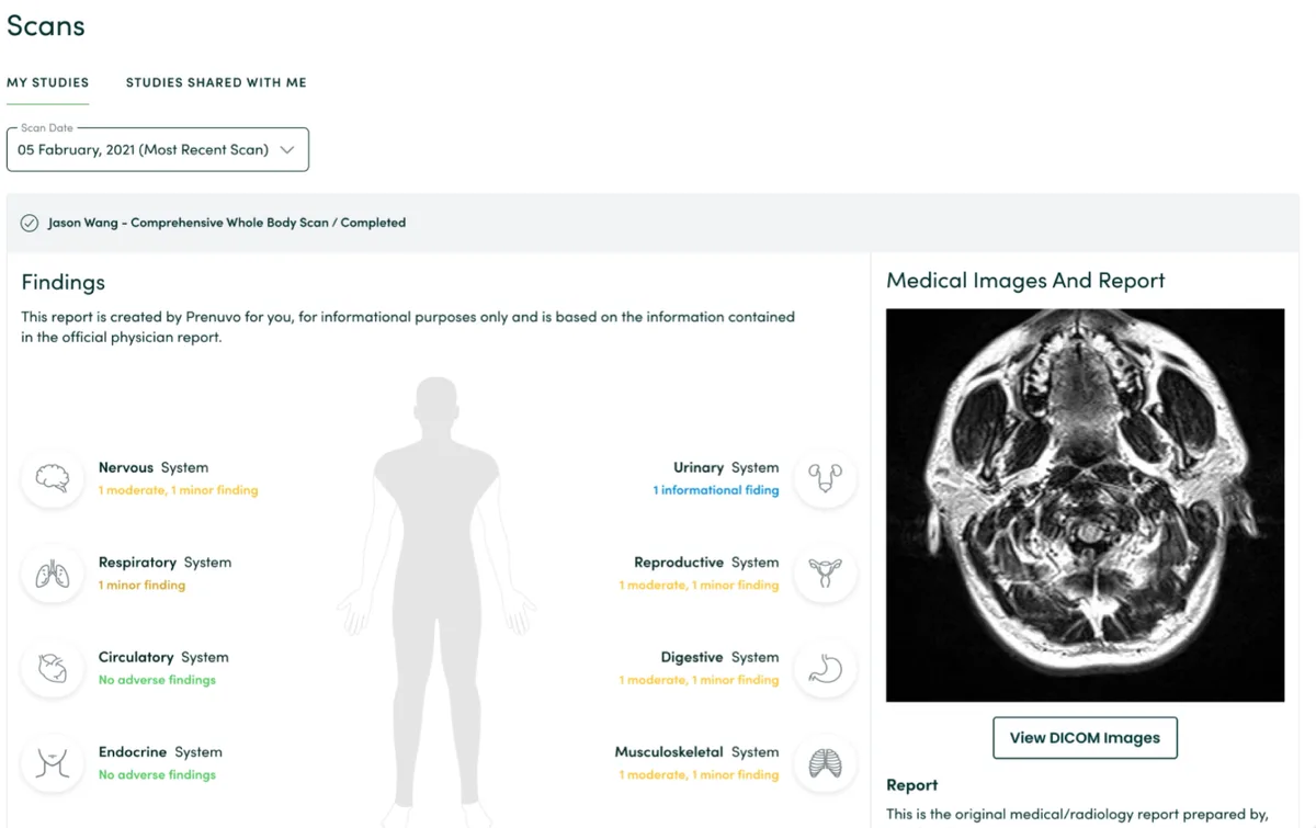 Example Prenuvo whole-body scan report showing findings graded by body system, alongside the MRI images and radiologist report