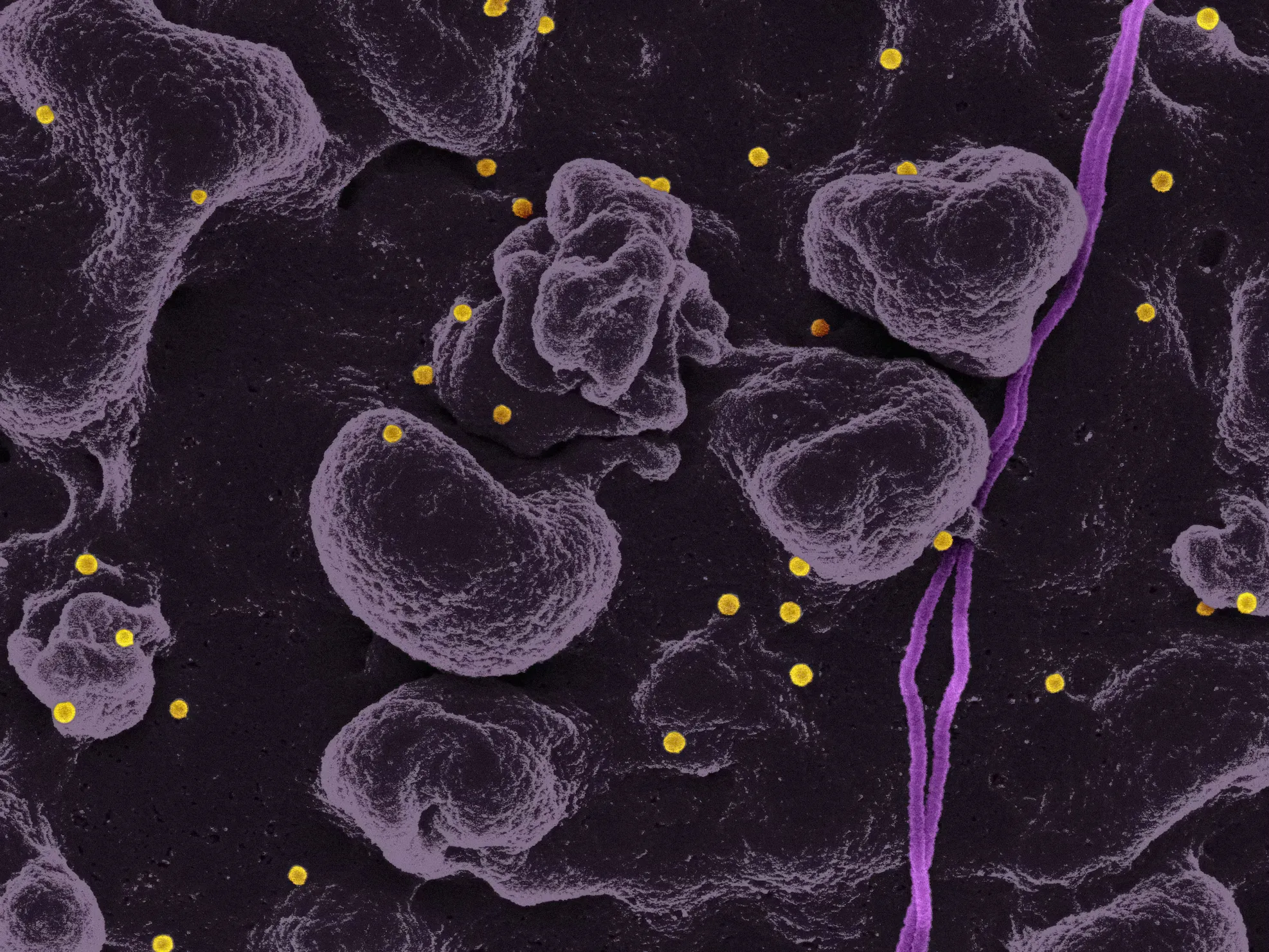 Low Progesterone Symptoms: Causes, Signs & What to Do