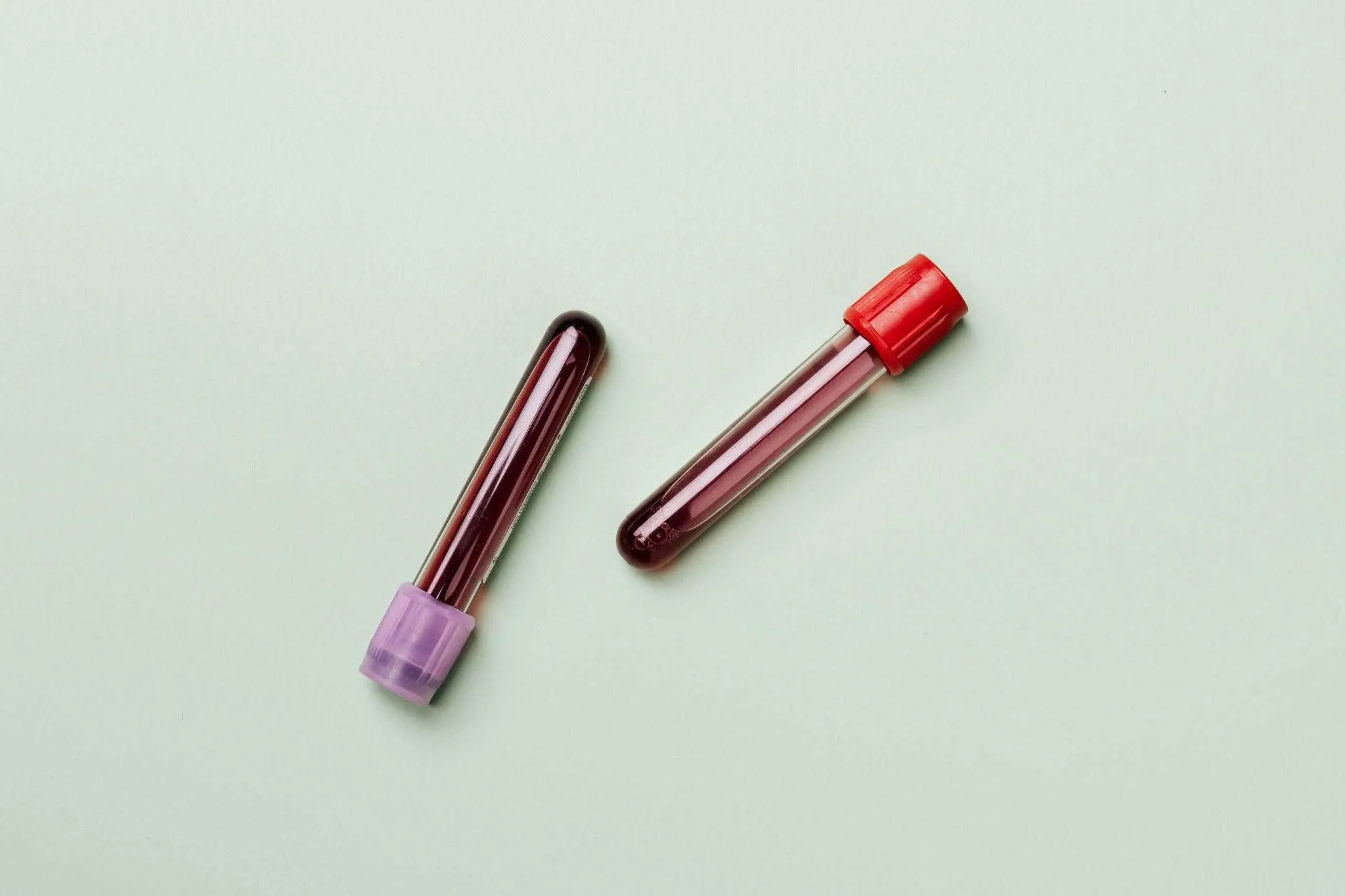 How to Manage Anemia and Ease Muscle Pain