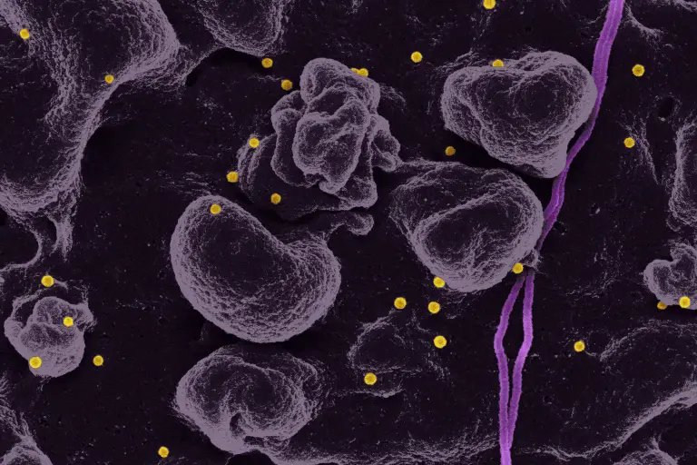 VLDL vs Total Cholesterol: Key Differences Explained