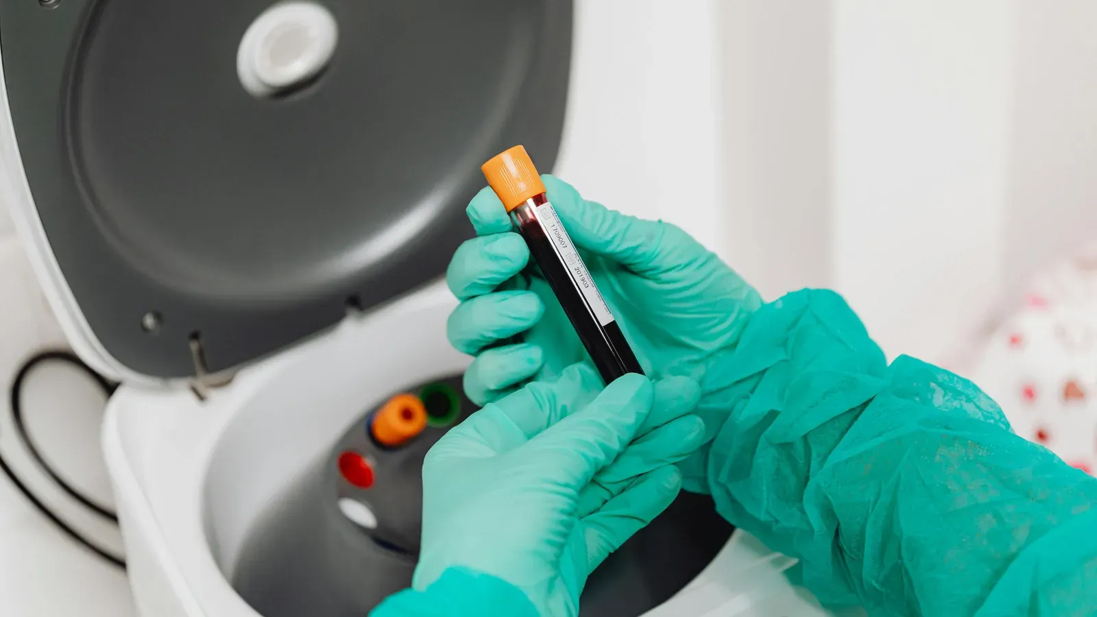 WBC Differential Explained: What Neutrophils, Lymphocytes, and Monocytes Reveal