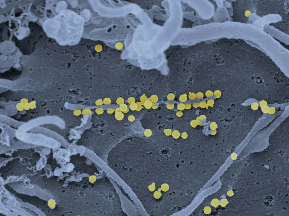 Microscopic image of gut microbes