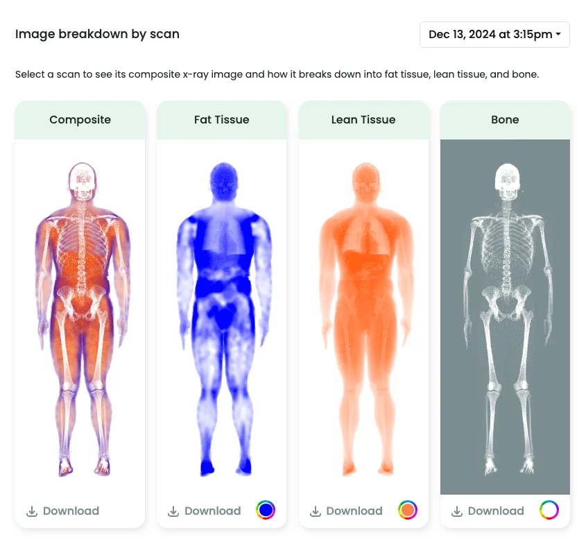 Example DEXA report showing the composite x-ray broken down into fat tissue, lean tissue, and bone