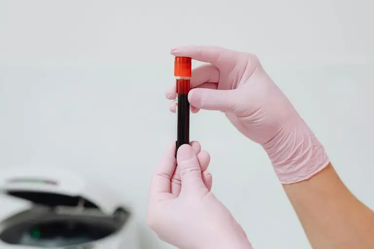 Testing for “Adrenal Fatigue” or Insufficiency