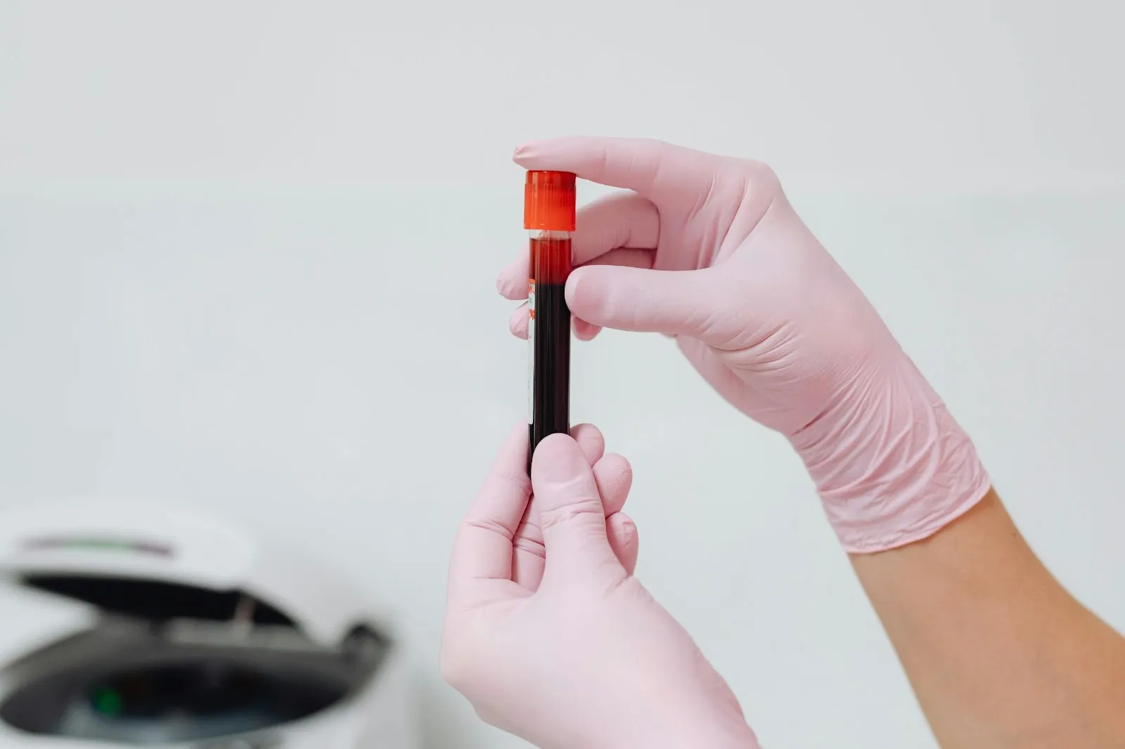 Testing for “Adrenal Fatigue” or Insufficiency