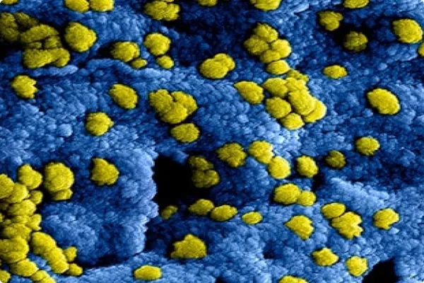 Environmental Allergy Profile