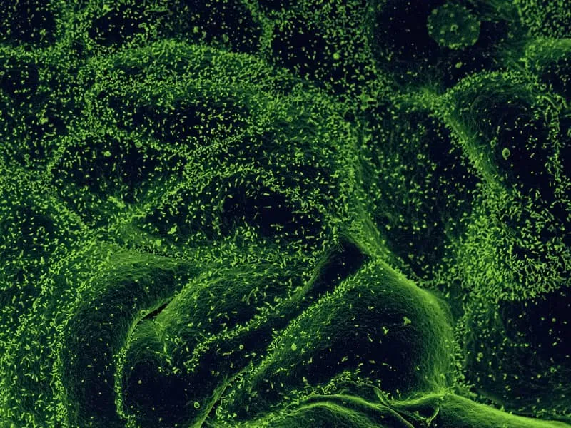 Autoimmune Disease Screen