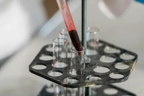 Blood Test for Lead Exposure Explained