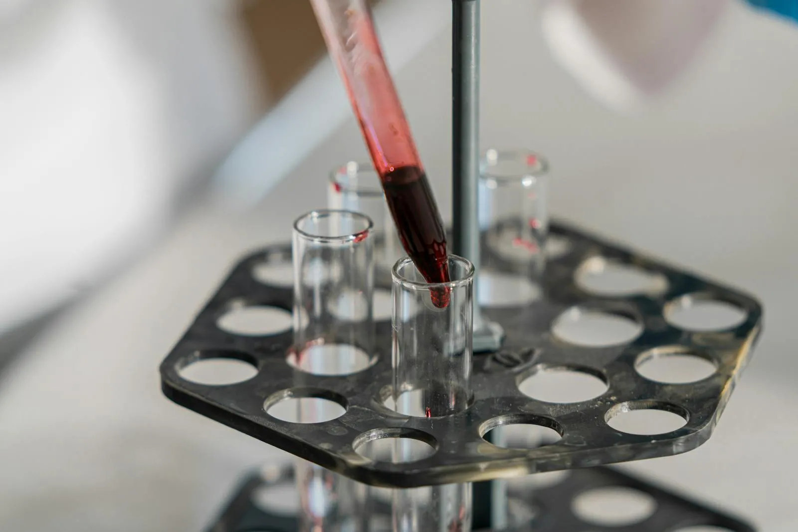 Blood Test for Lead Exposure Explained