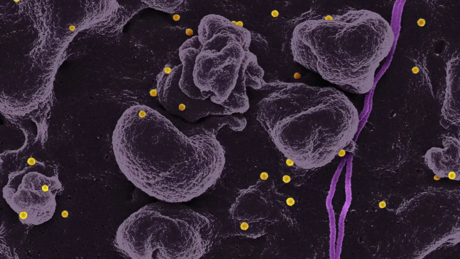 High Mch Symptoms: Causes, Signs & What to Do