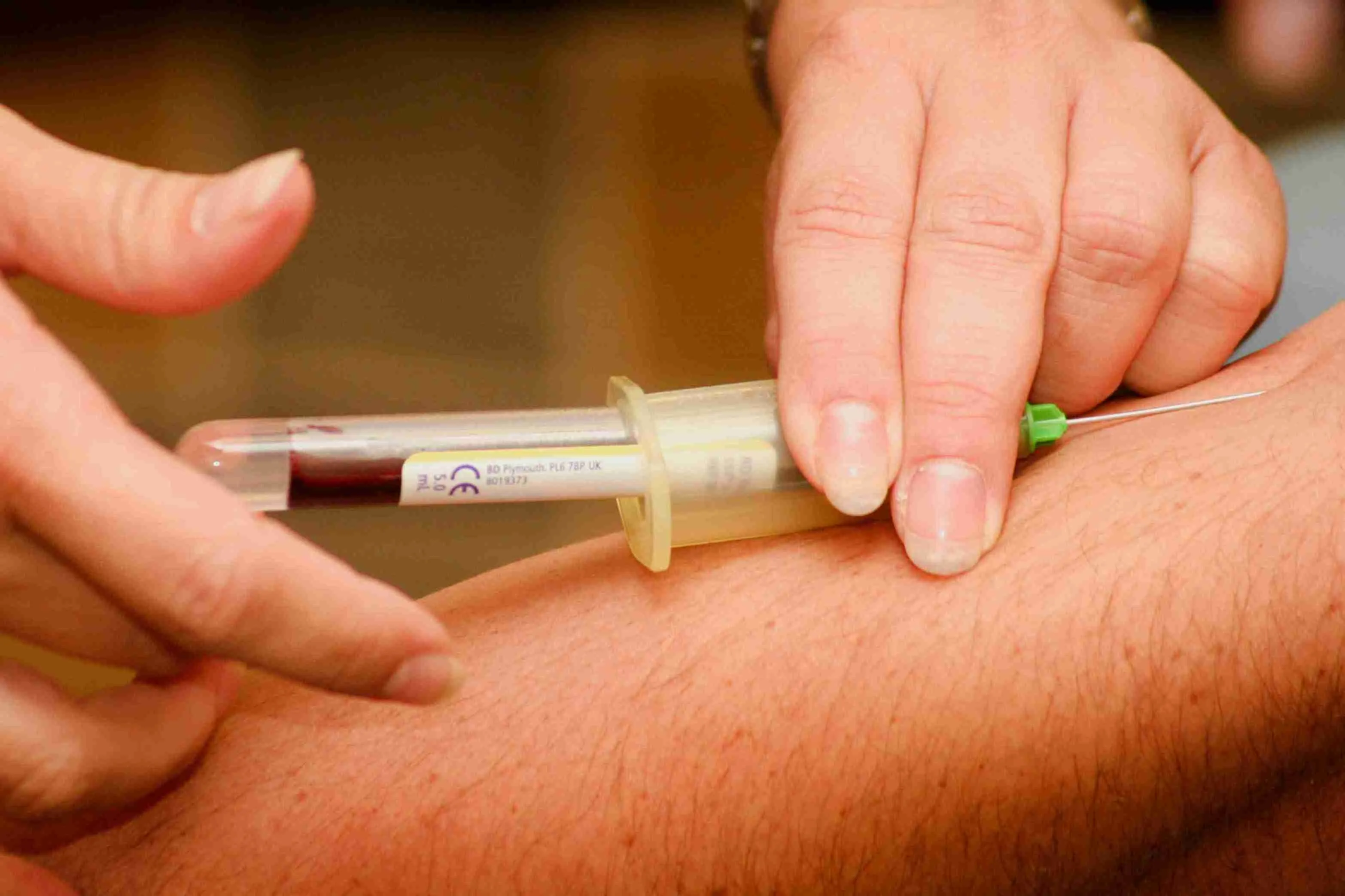 Does Total Cholesterol Matter in Your Blood Test?