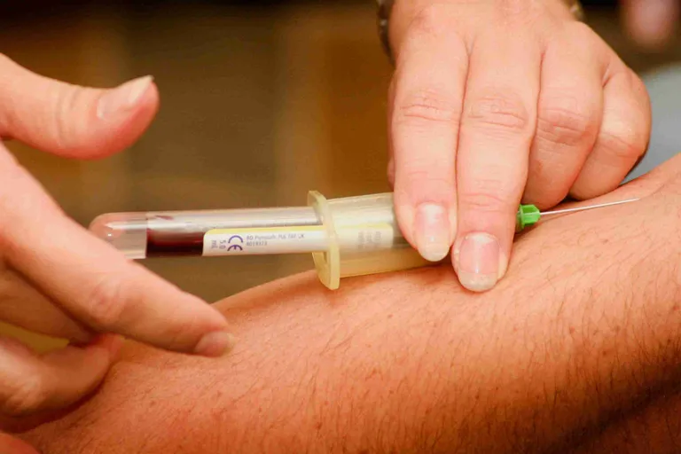 Does Total Cholesterol Matter in Your Blood Test?