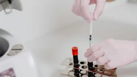 Wbc Differential Explained What Neutrophils Lymphocytes and Monocytes Reveal