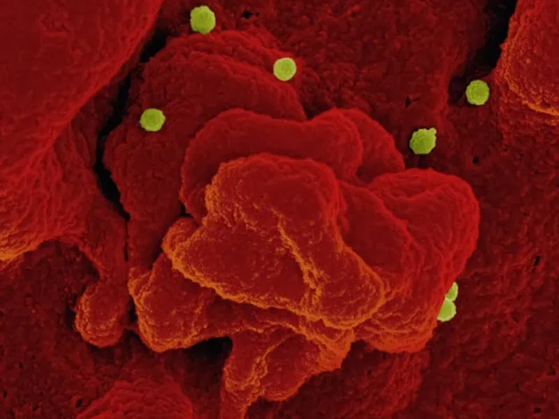 Thyroid Autoimmunity Screen