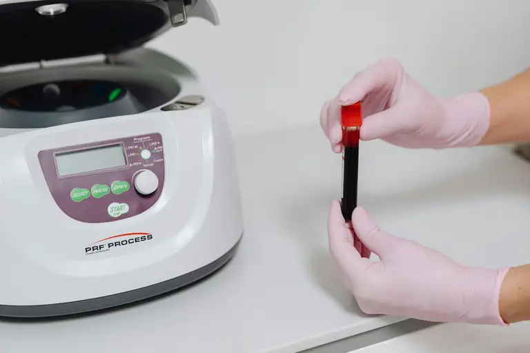 Why Blood Tests Might Miss Magnesium Problems