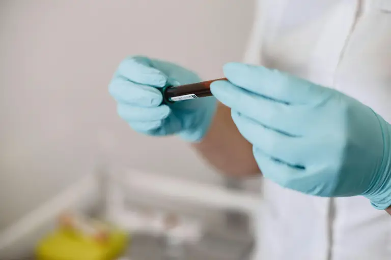 What Is a Cortisol Test?